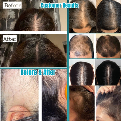 RootRenew™ - The 4-in-1 Pod Based Hair & Scalp