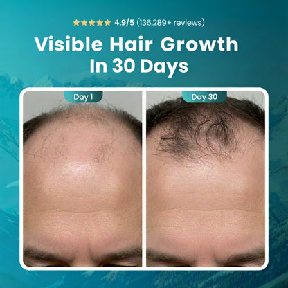 RootRenew™ - The 4-in-1 Pod Based Hair & Scalp