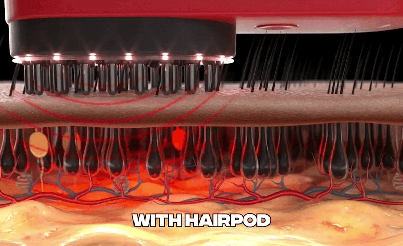 RootRenew™ - The 4-in-1 Pod Based Hair & Scalp