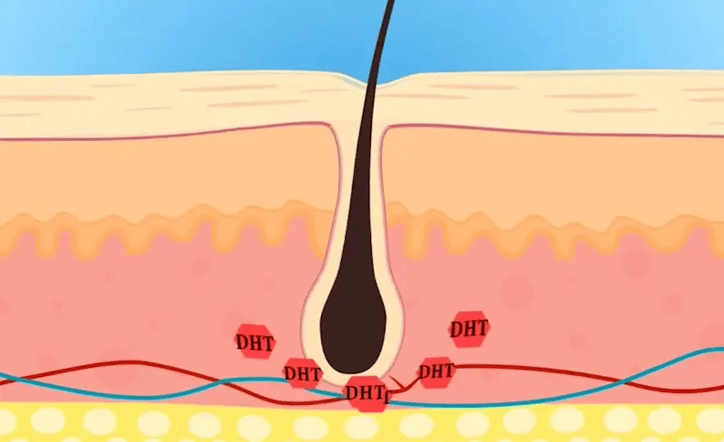 RootRenew™ - The 4-in-1 Pod Based Hair & Scalp