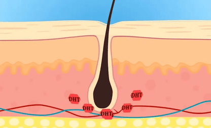 RootRenew™ - The 4-in-1 Pod Based Hair & Scalp