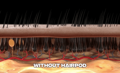RootRenew™ - The 4-in-1 Pod Based Hair & Scalp