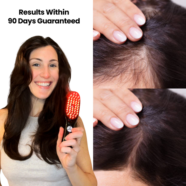 HairRenew™ - LED Light Therapy Brush